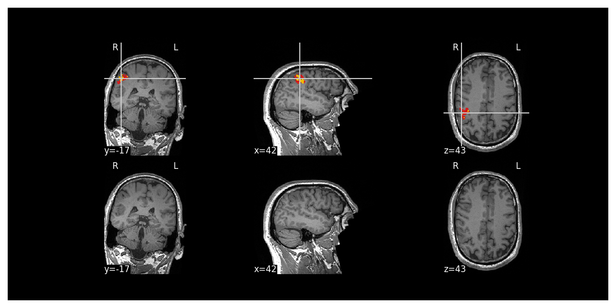 mri