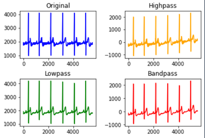 ECG_filter_types