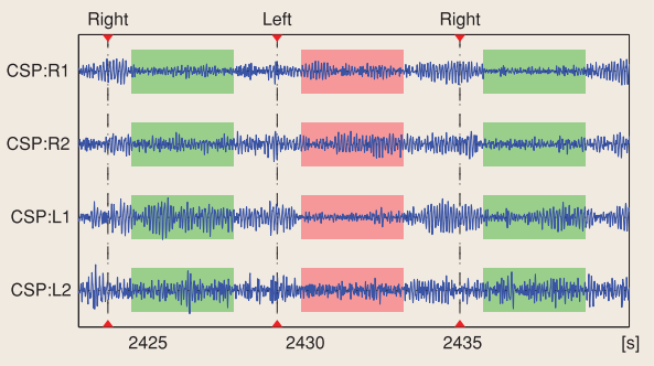 Effect of spatial CSP filtering. CSP analysis was performed to obtain four spatial filters that discriminate left from right hand motor imagery. The graph shows continuous band-pass filtered EEG after applying the CSP filters. The resulting signals in filters CSP:L1 and CSP:L2 have larger variance during right hand imagery (segments shaded in green) while signals in filters CSP:R1 and CSP:R2 have larger variance during left hand imagery (segment shaded red).