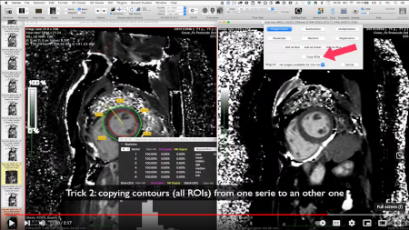 T1, ECV multislice CMR post-processing