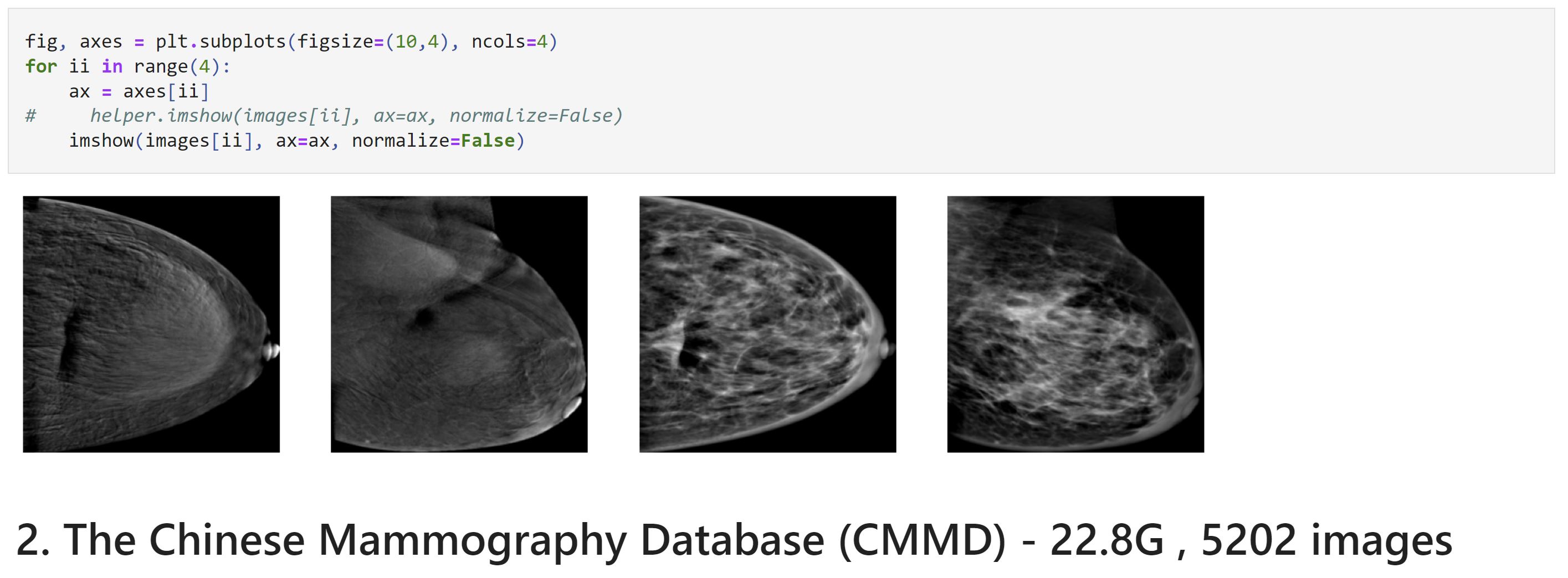 chinese_mammography_db_images_yoonjung.jpg