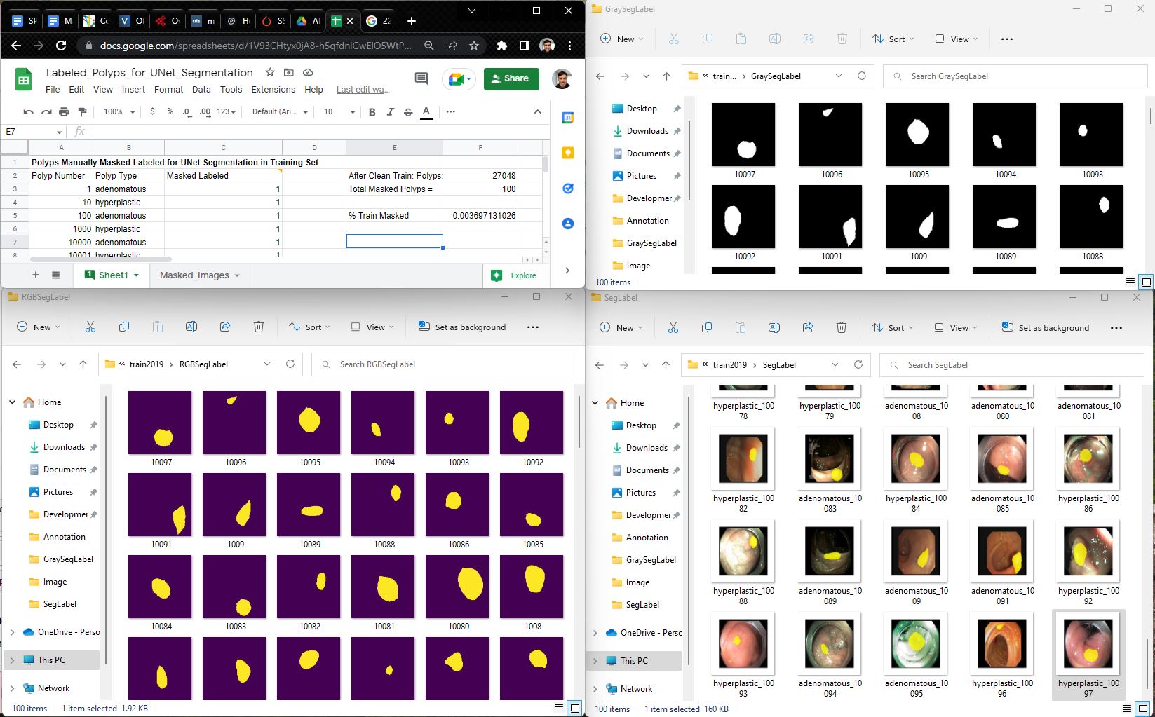 100_manually_masked_polyps_for_unet