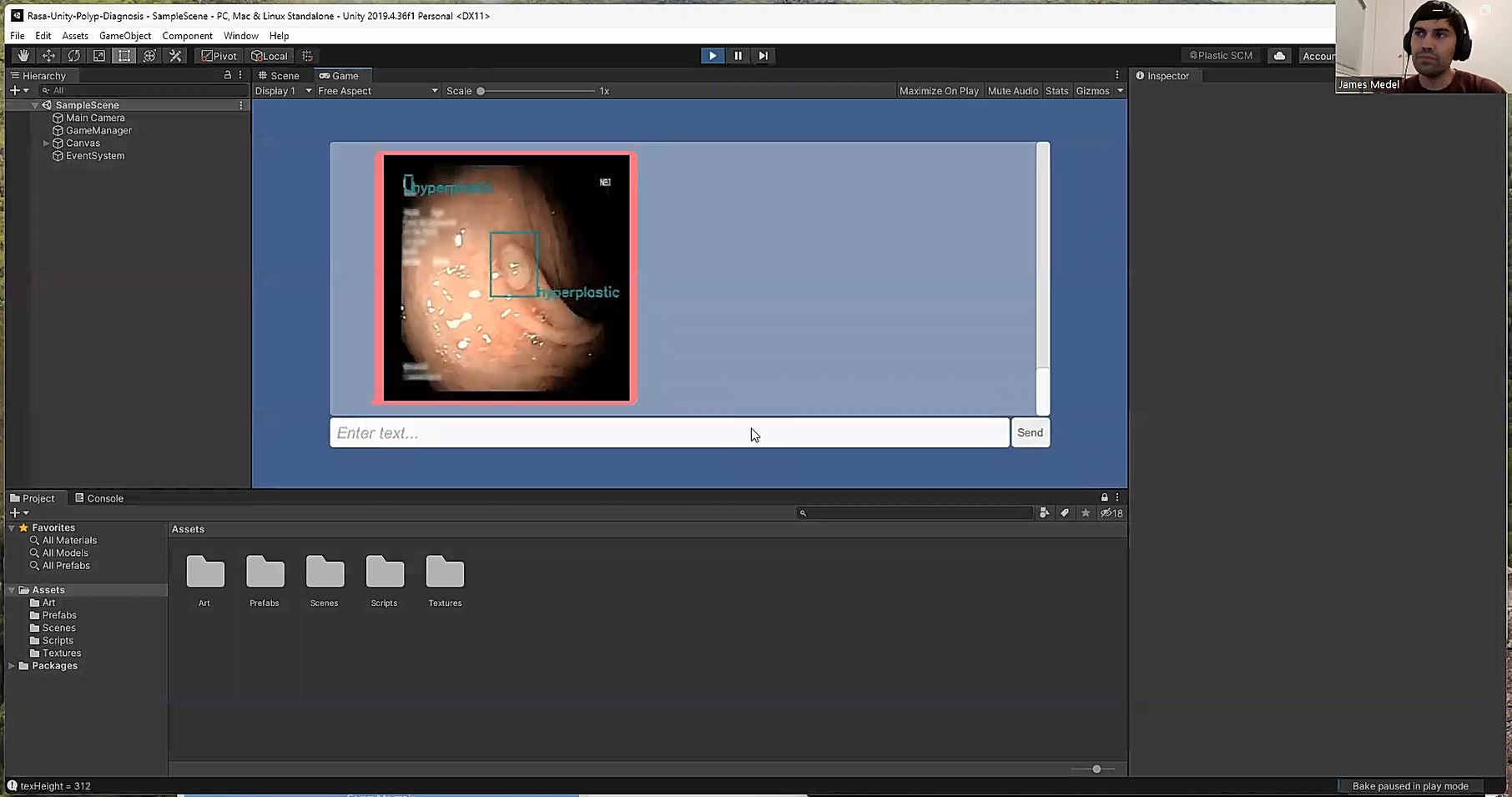 rasa_unity_patient_polyp_diagnosis