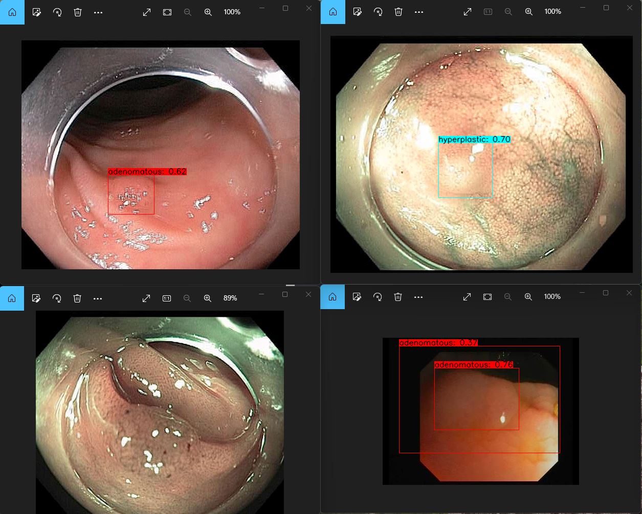 yolov4_polyp_detection_4_images_5_6_22