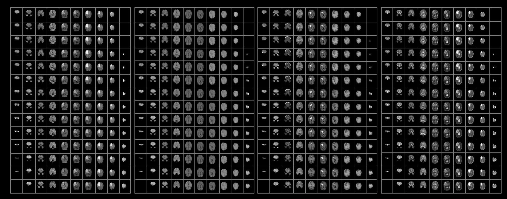 All images produced from a single patient brain scan.