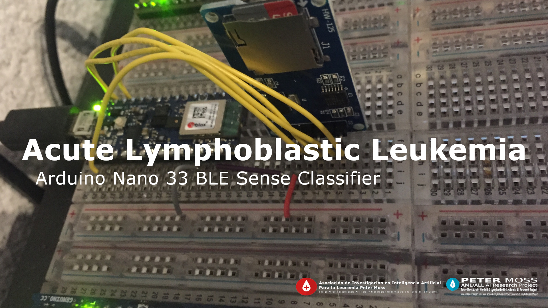 Acute Lymphoblastic Leukemia Arduino Nano 33 BLE Sense Classifier