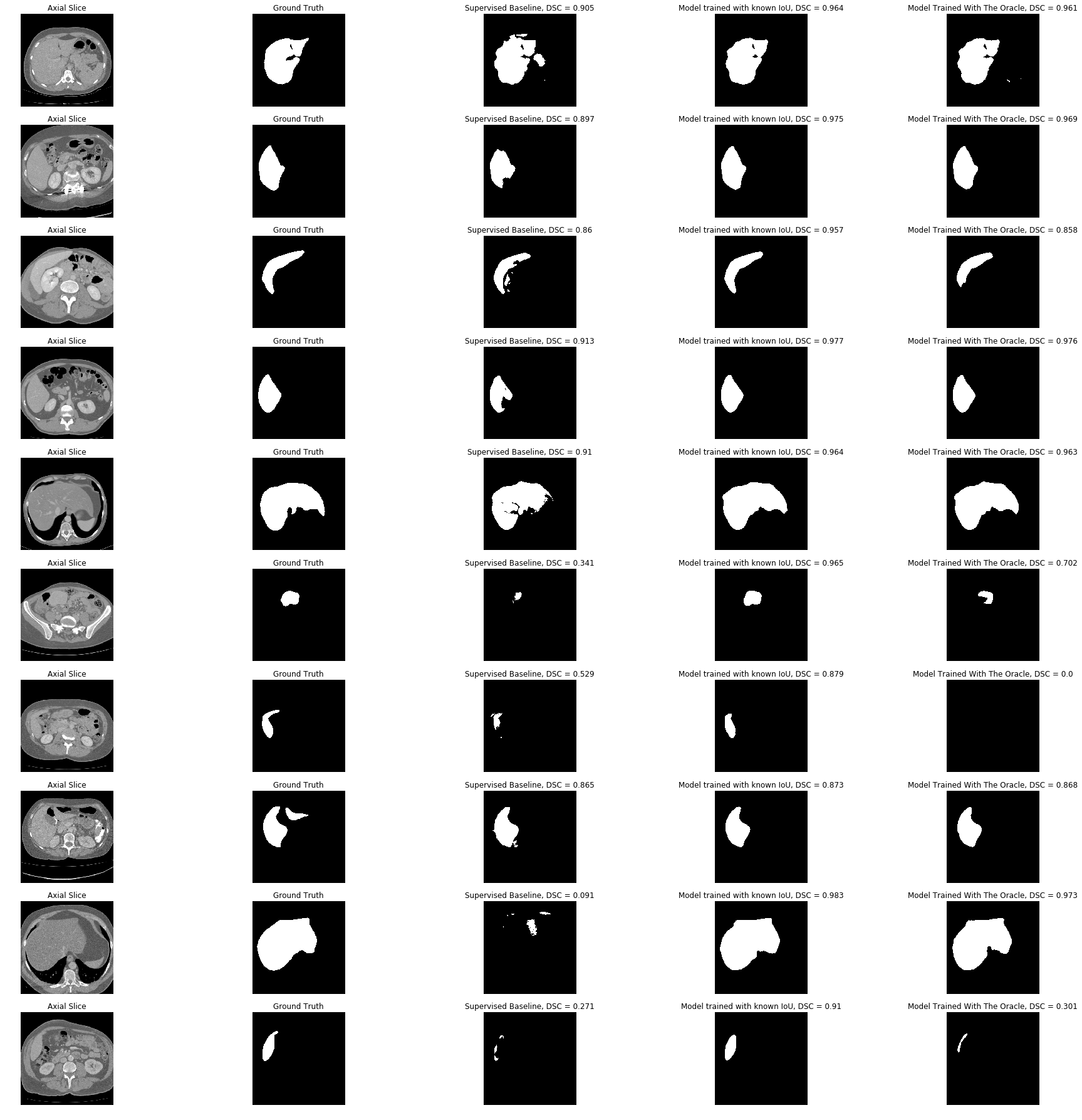 Computing segmentation on CT scans used in the semi-supervised learning