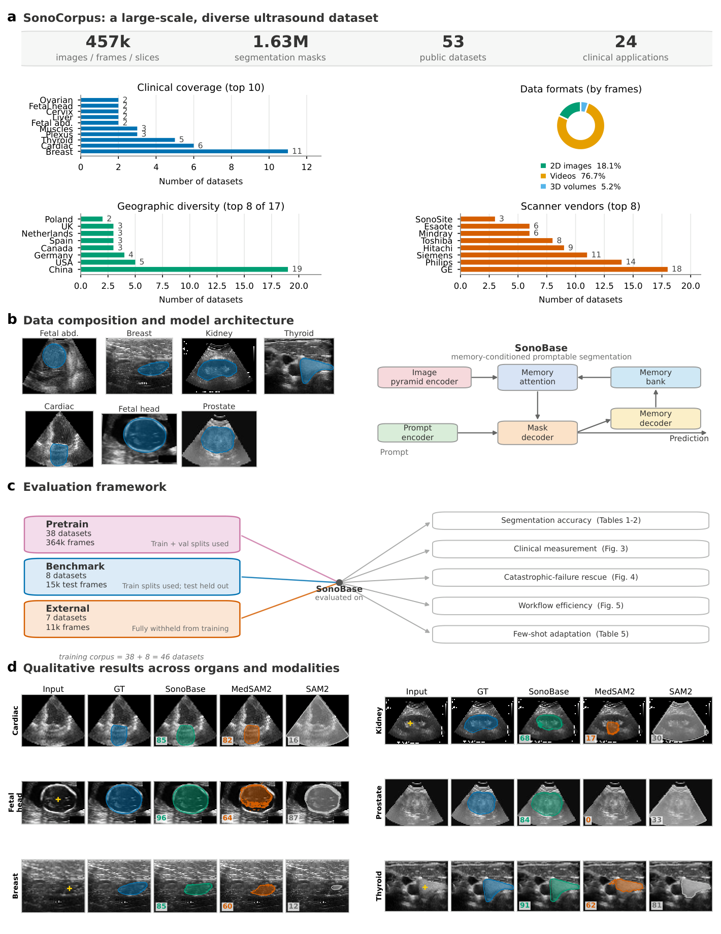 SonoCorpus and SonoBase overview