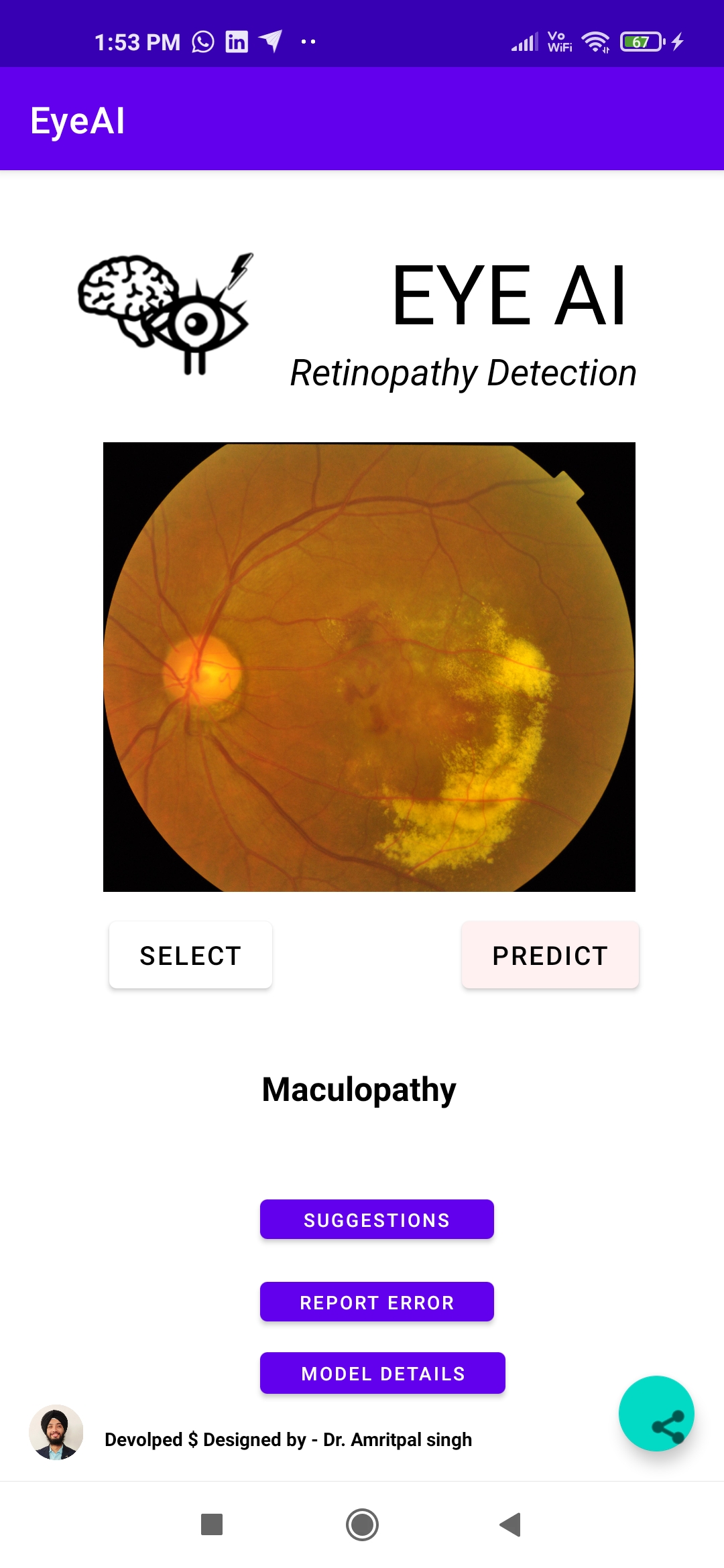 Maculopathy
