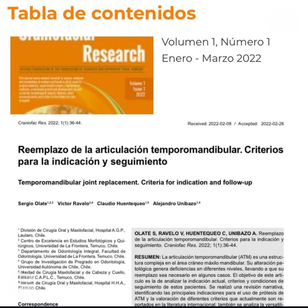Noticia 4