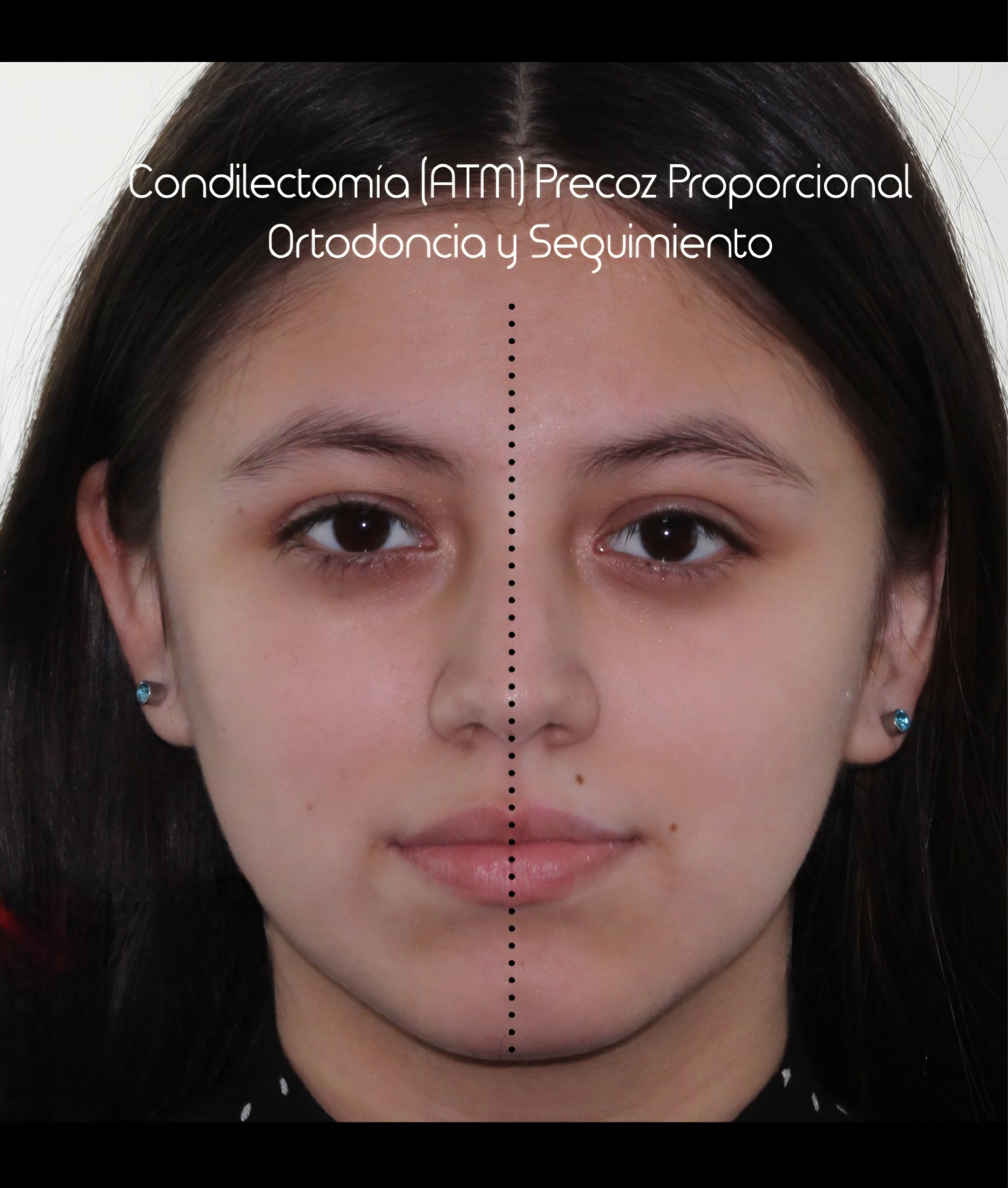 Proc nuevo