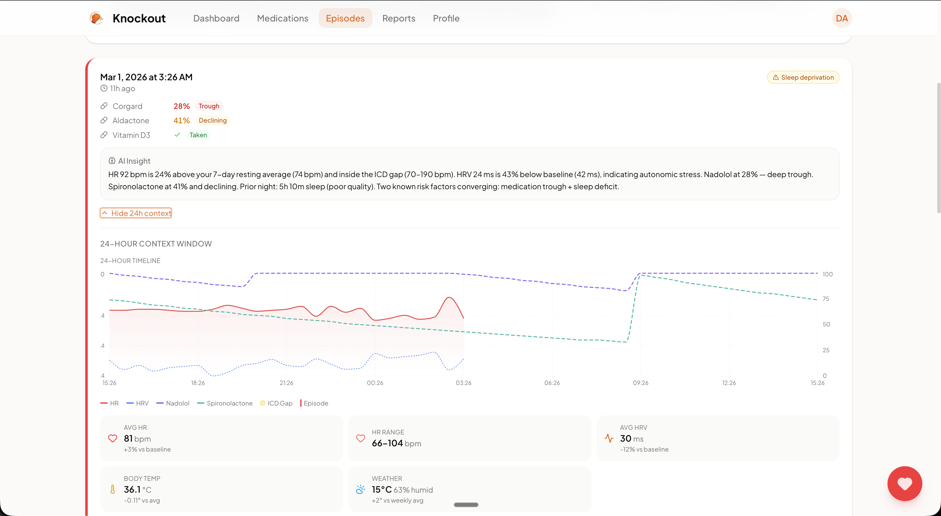 Episode timeline view showing cardiac event log