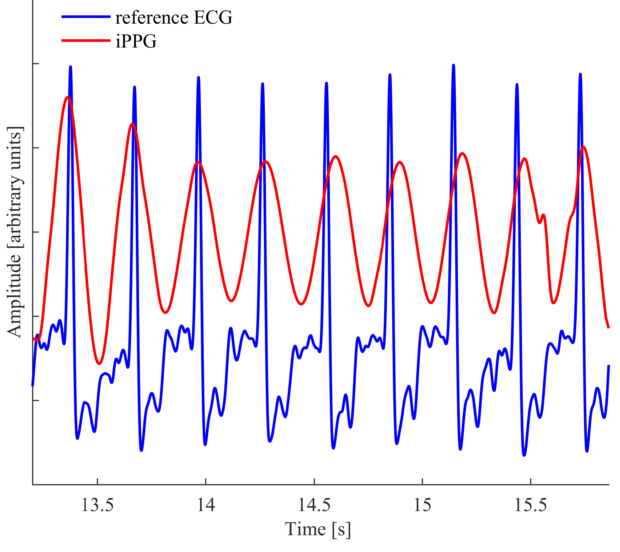 example of imaging photoplethysmogram with corresponding EEG signal