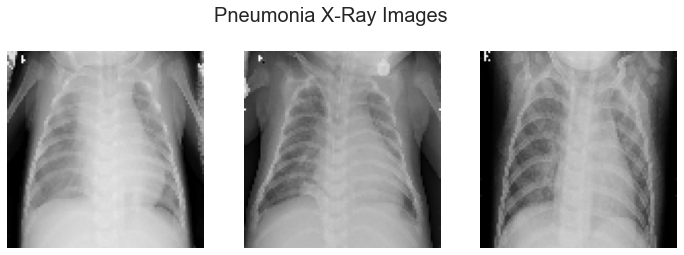 pneumonia