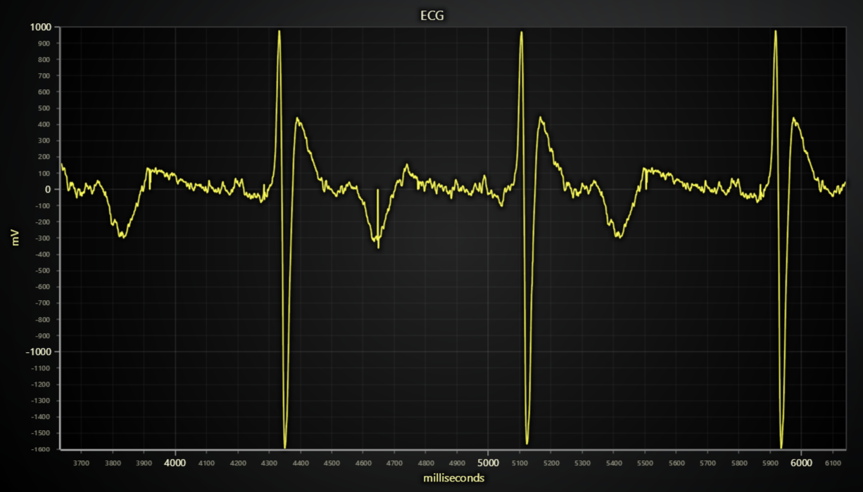 JavaScript ECG Chart