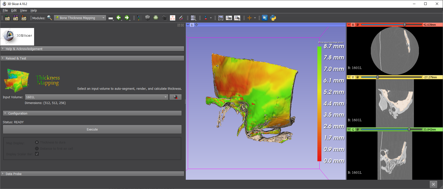 Slicer 4.10.2: Summary, Highlights and Changelog - Release Notes - 3D Slicer  Community