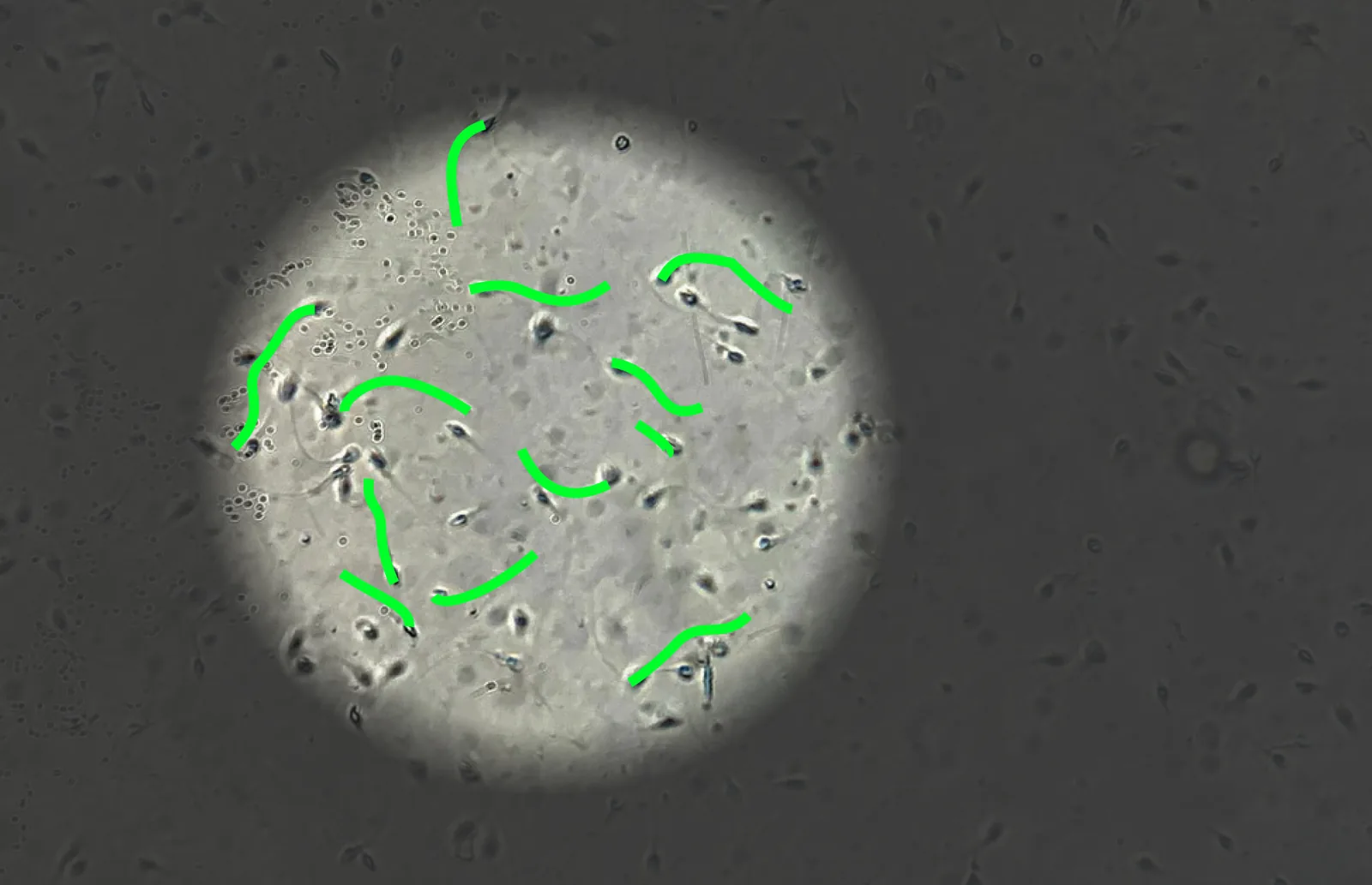sperm motility analysis microscope field evaluation avare biotech