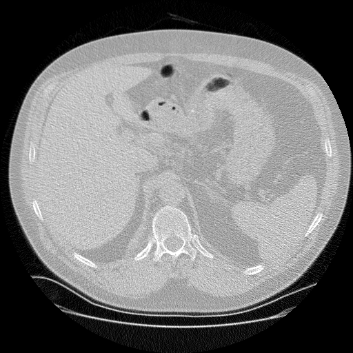 Example CT Scan