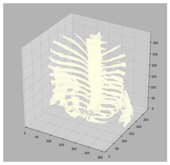 3D Visualization of the CT Scan