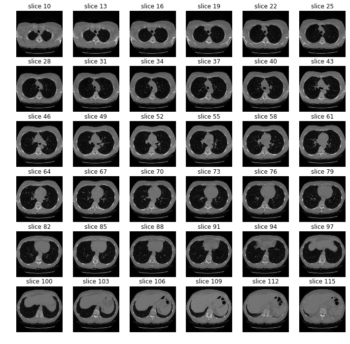 Final stack of CT scans for a patient