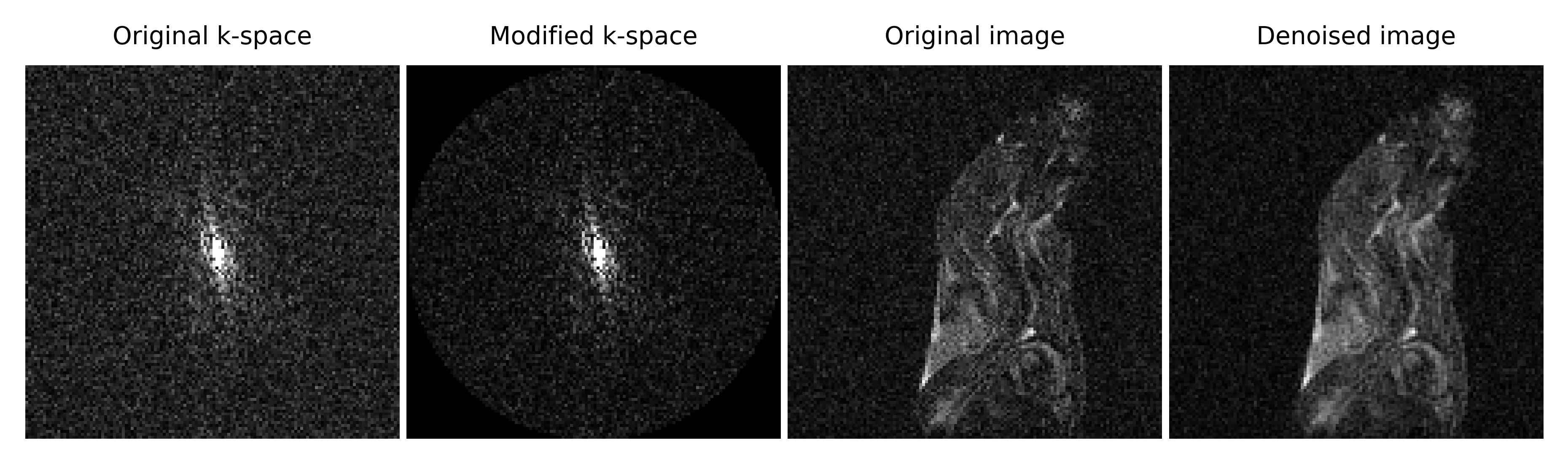 Figure1