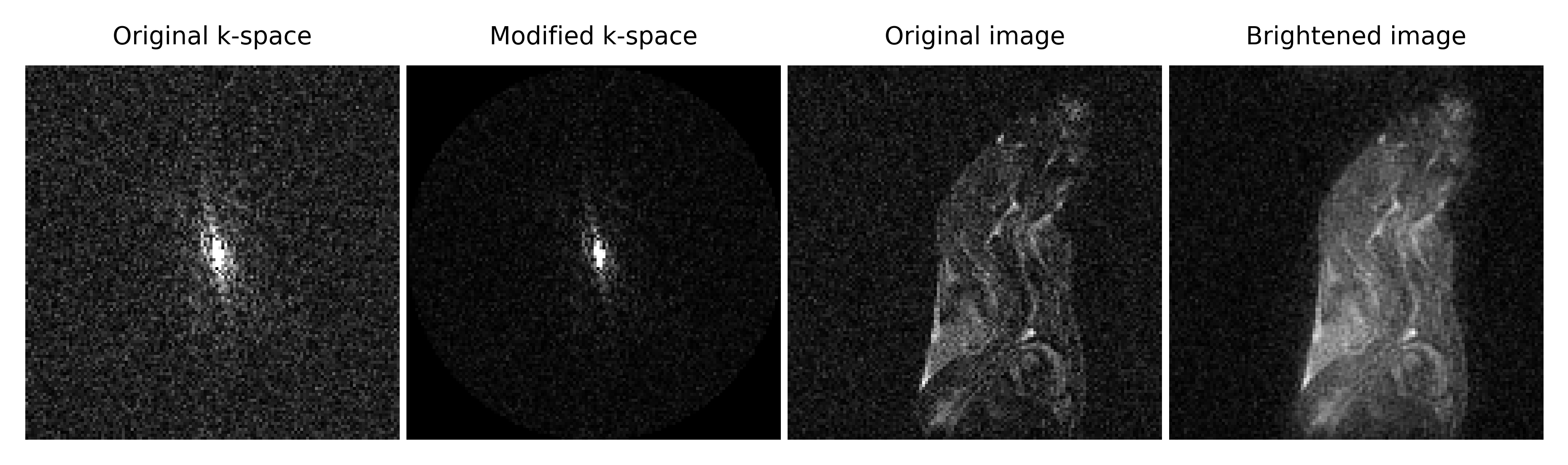 Figure2