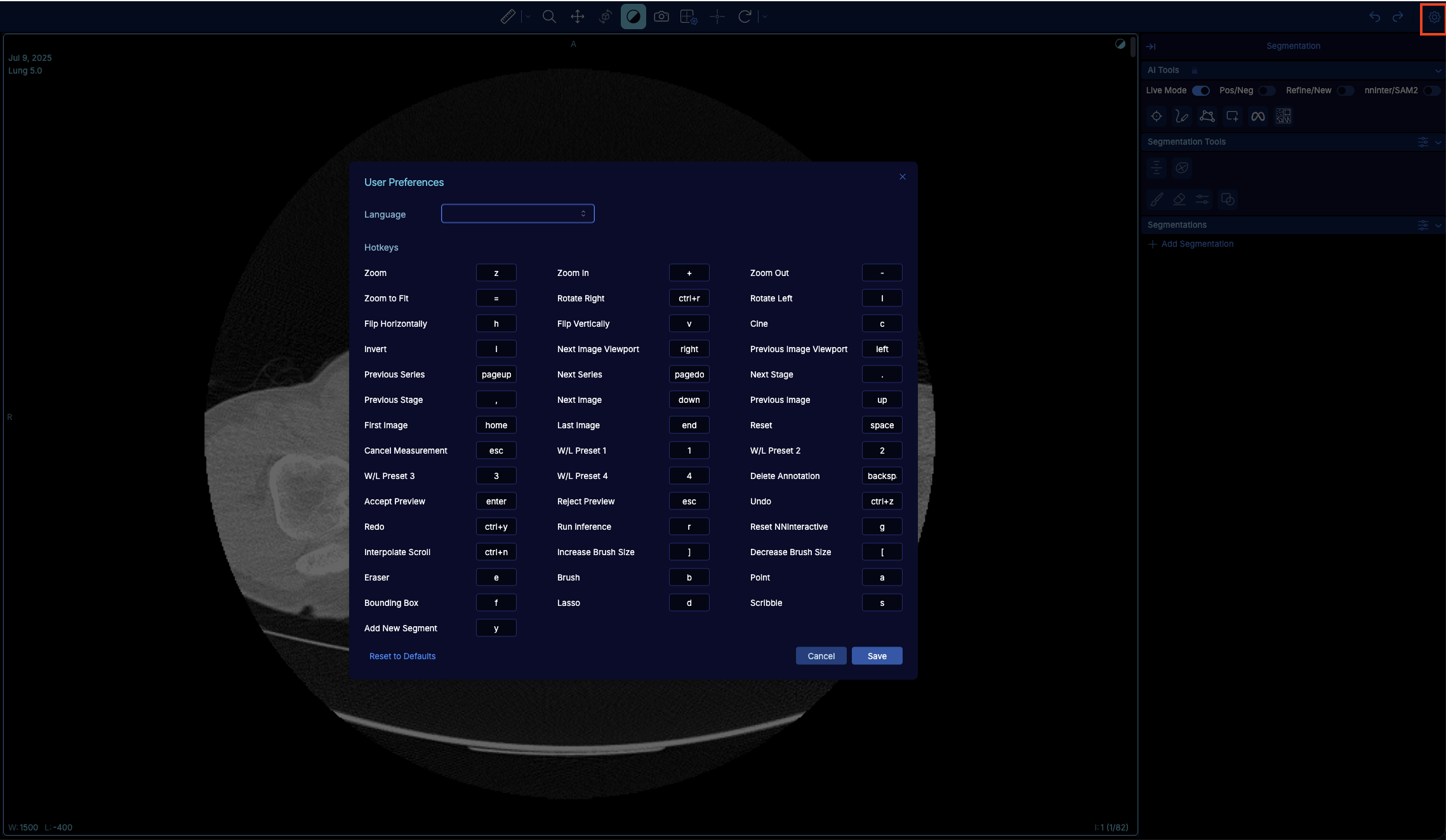 List of hotkeys