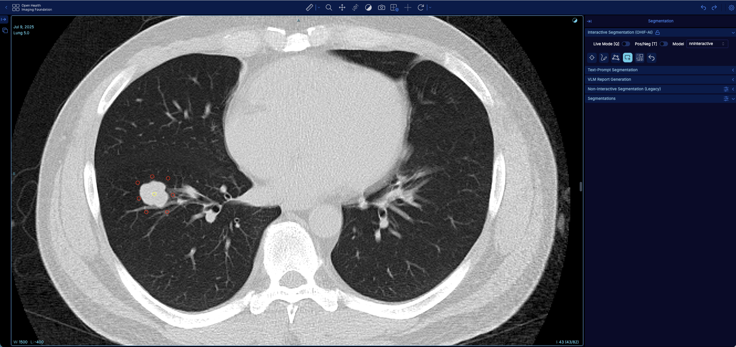 Neg Point Example