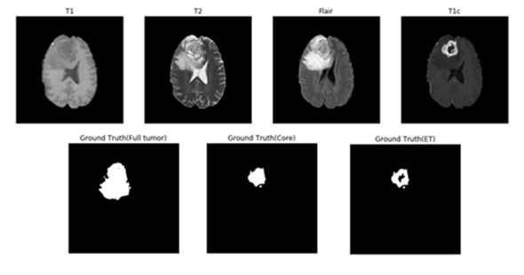 MRI contrast example