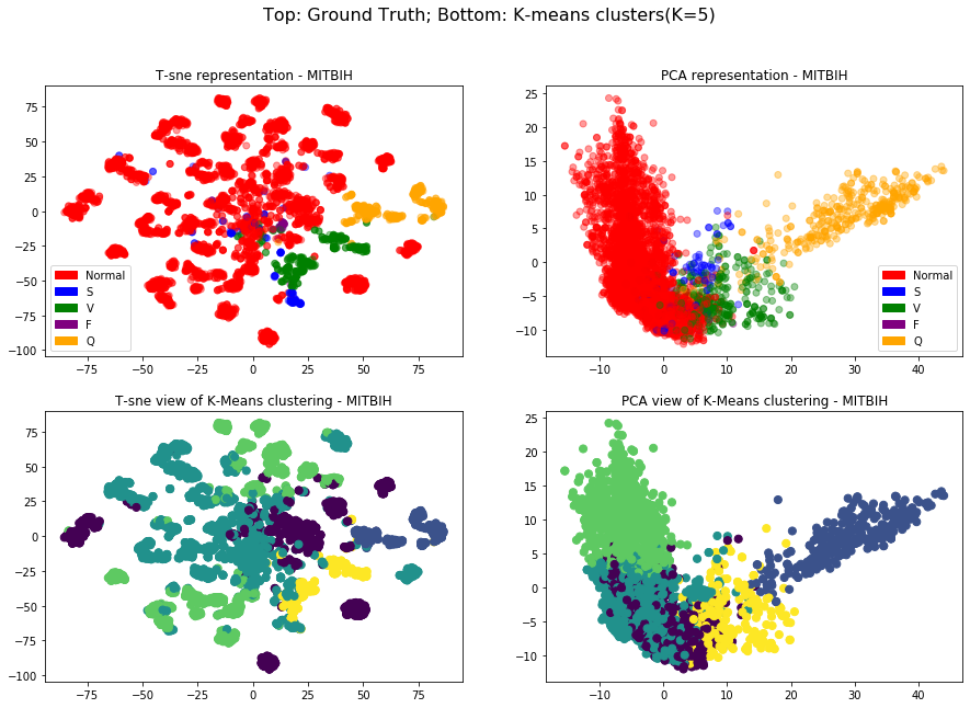 MITHIB dataset