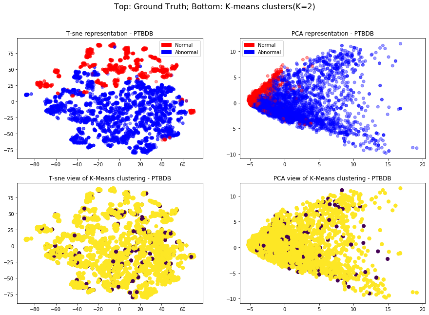 PTBDB dataset