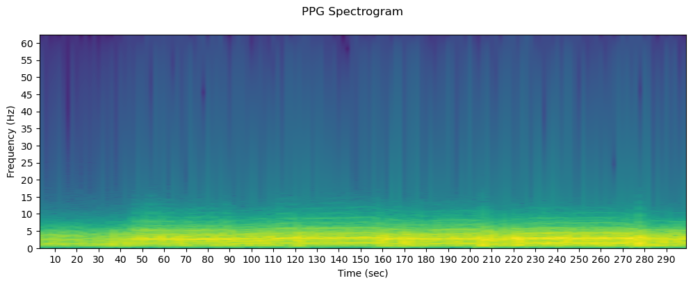 PPG Spectrogram