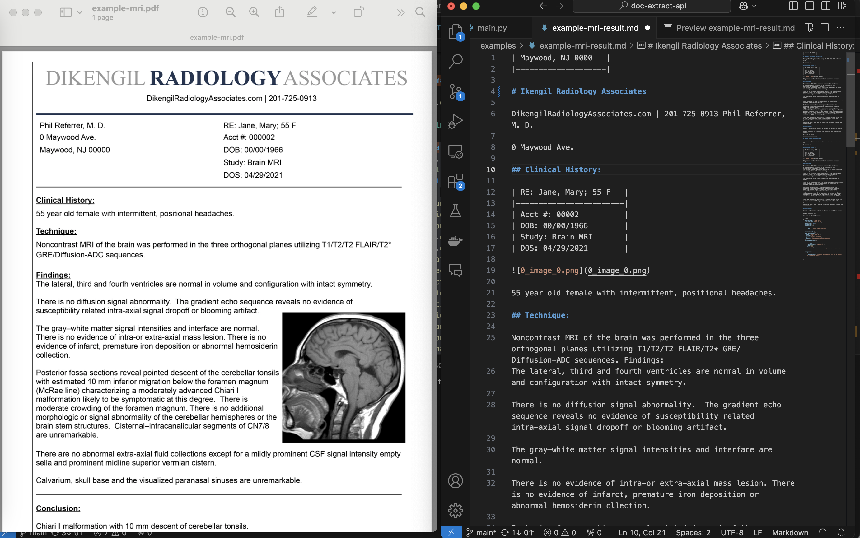 Converting MRI report to Markdown