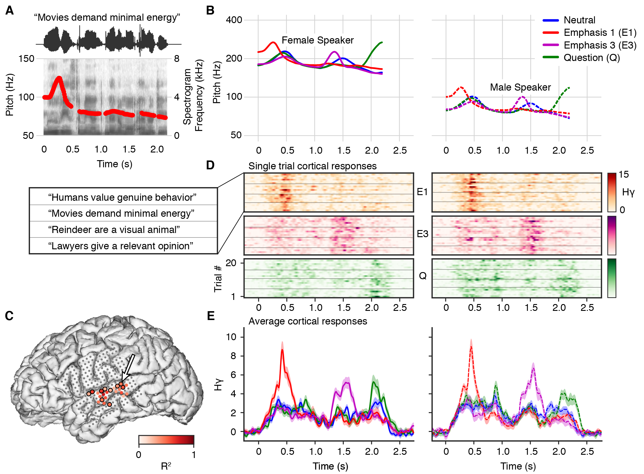 Figure showing neural responses to speech stimuli with different intonation contours