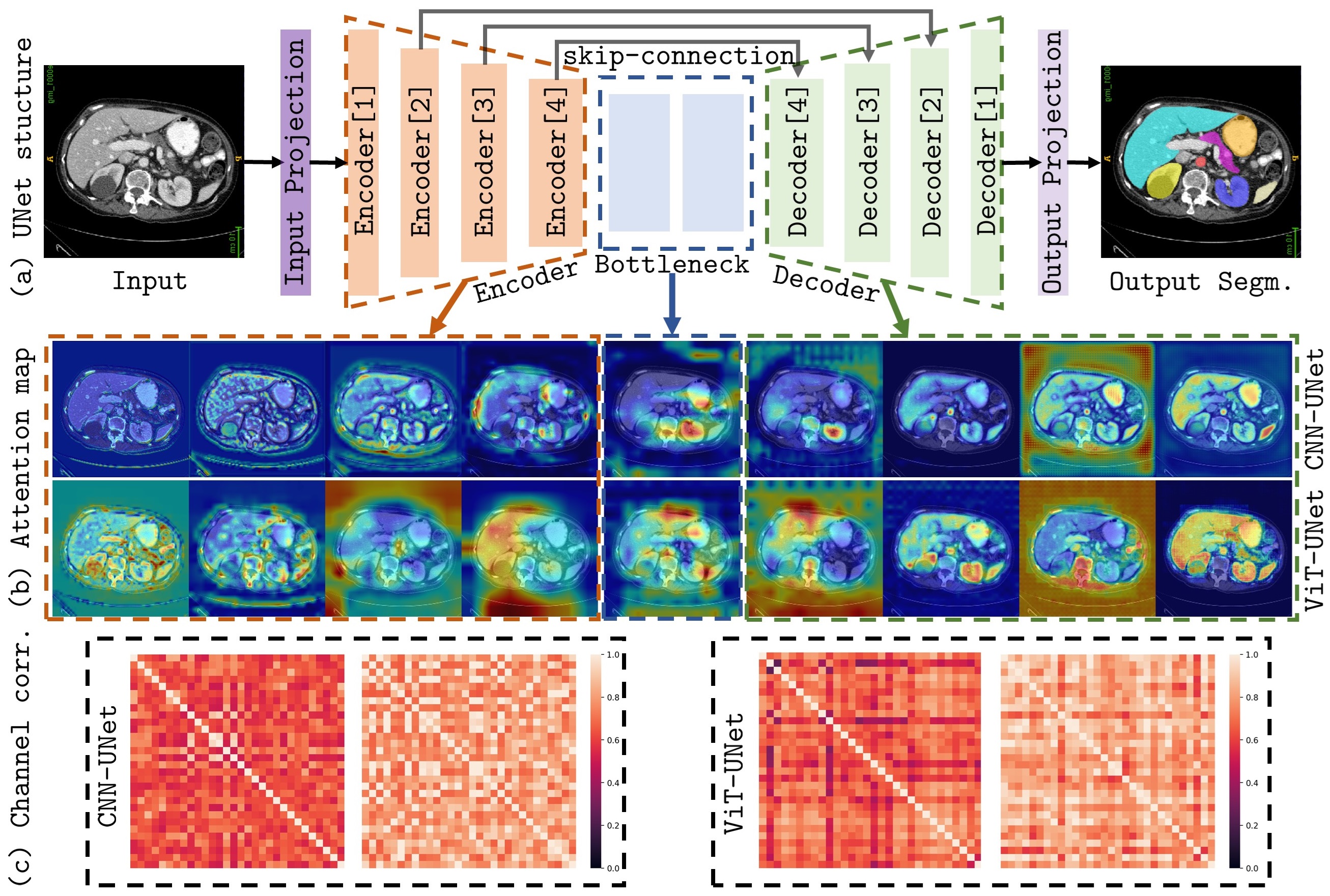 SelfReg-UNet: Self-Regularized UNet for Medical Image Segmentation ...