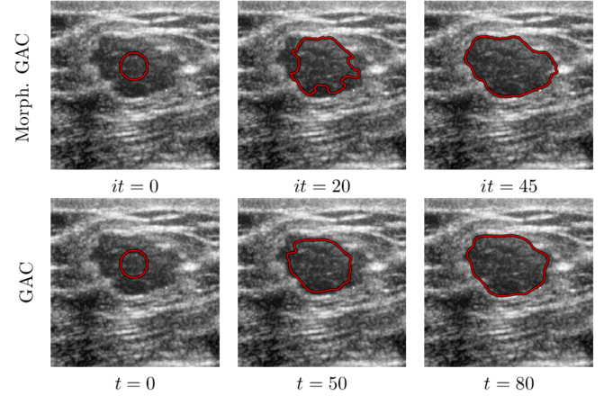 Figure_nodule