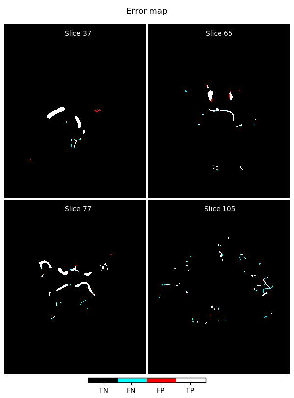 error map of segmentation with full unet