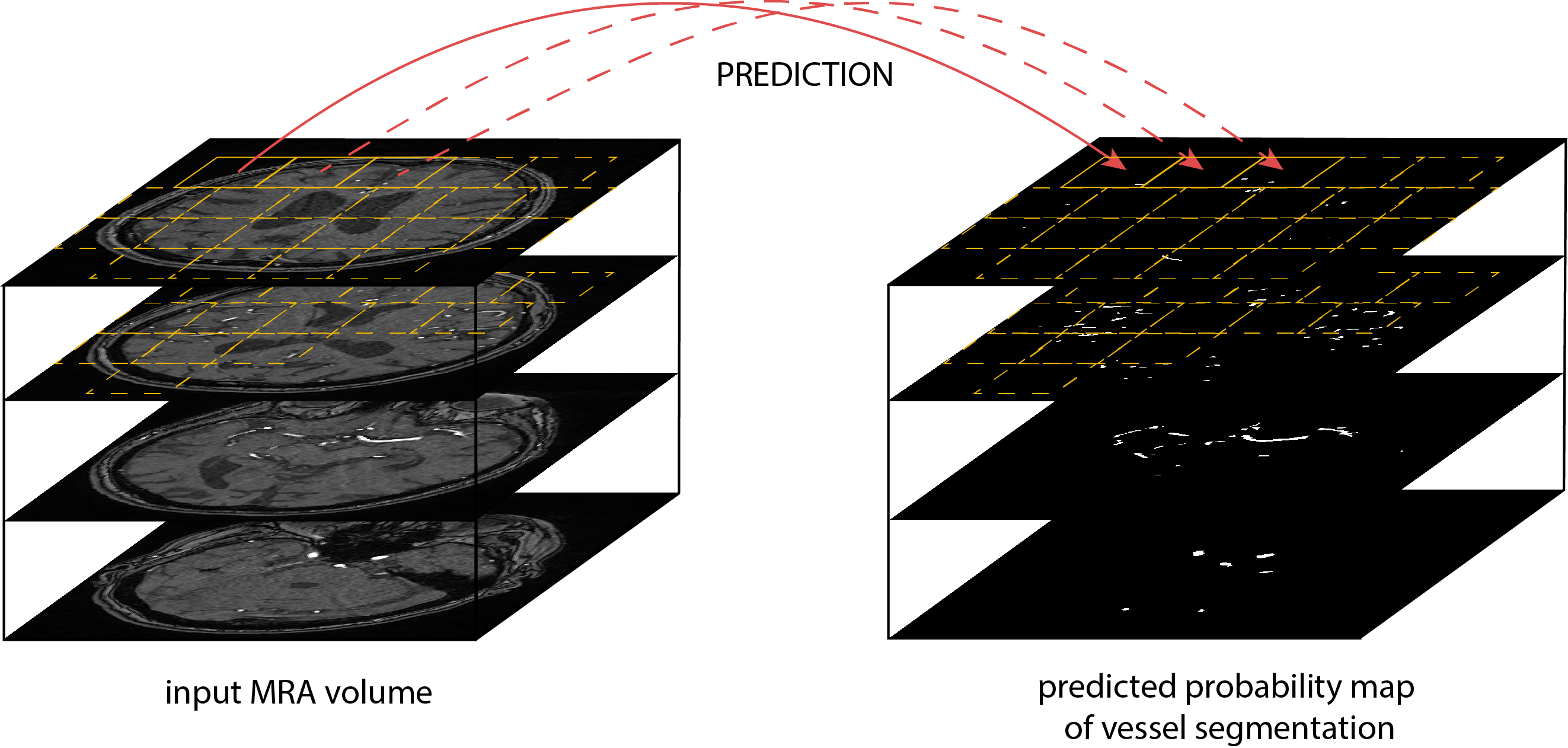 vasculature reconstruction