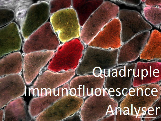 Raw quadruple immuno data