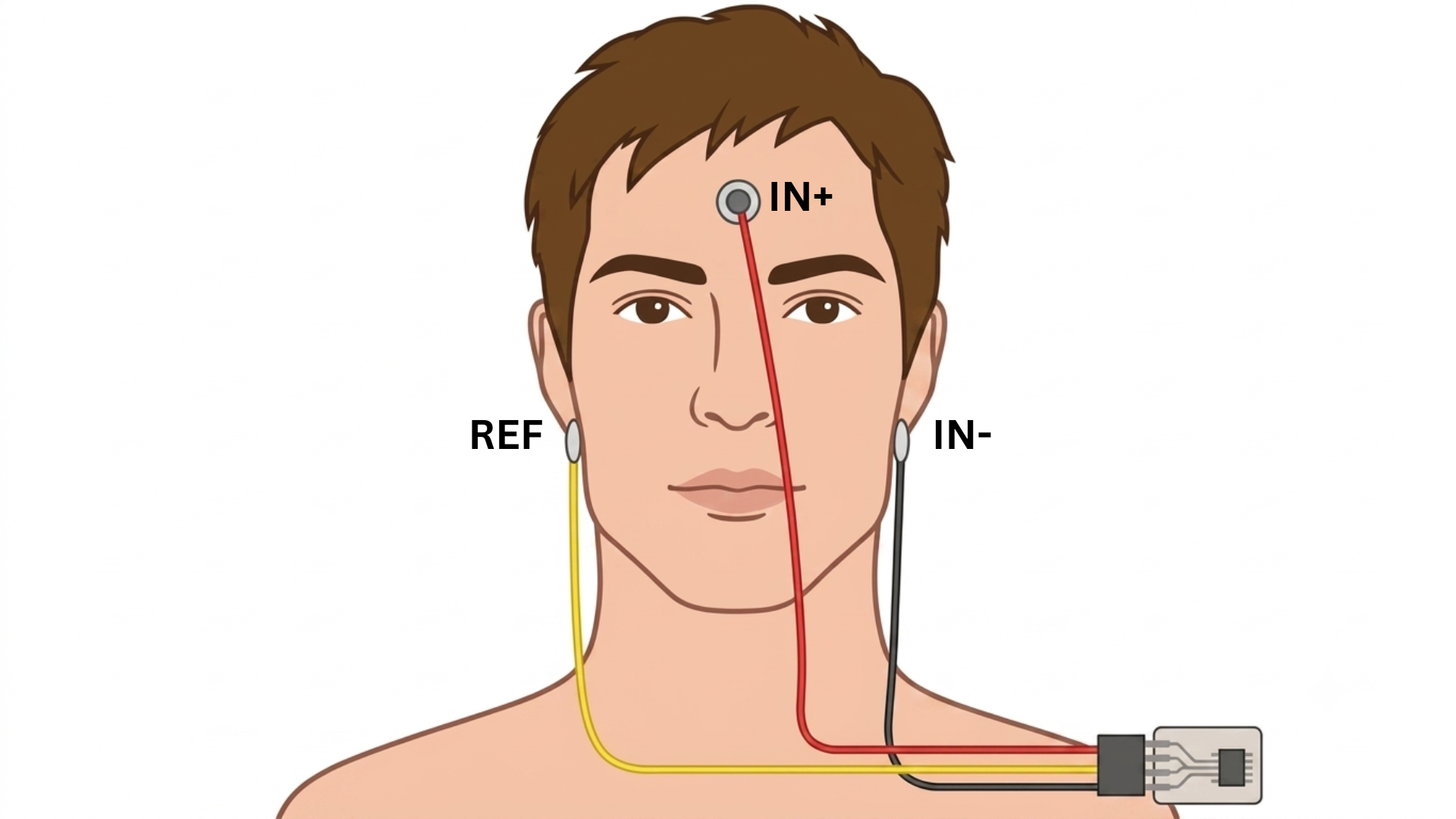 Electrode Placement Diagram