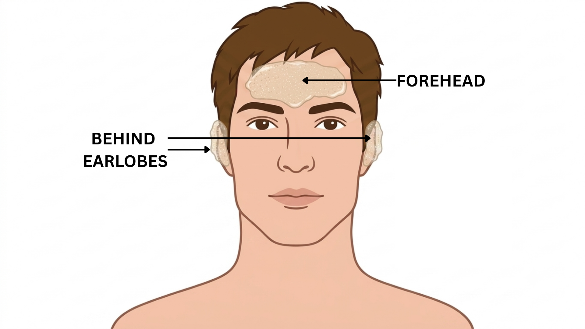Skin Preparation
