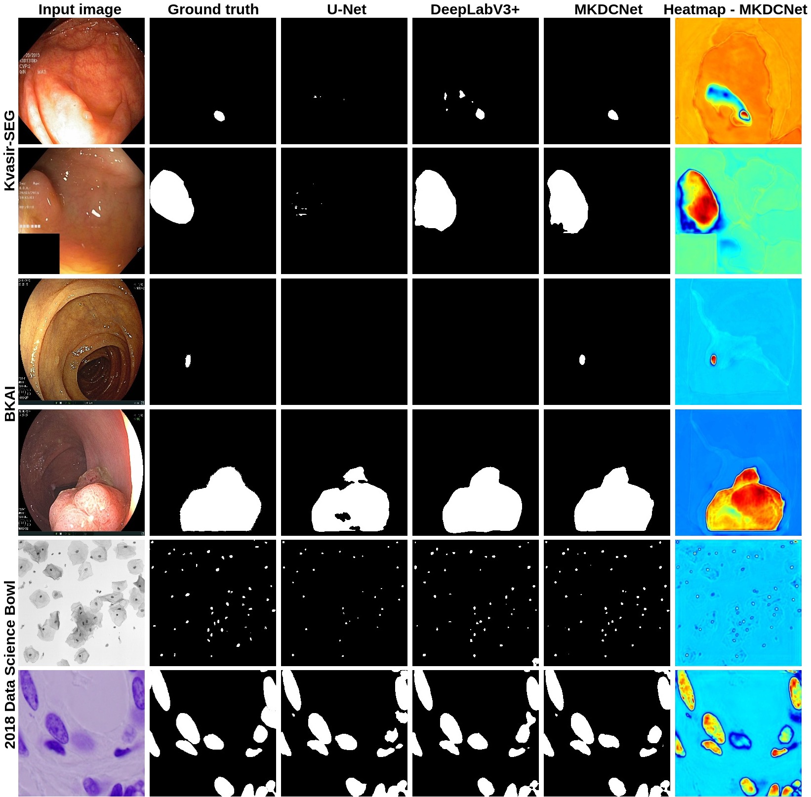 Qualitative result comparison