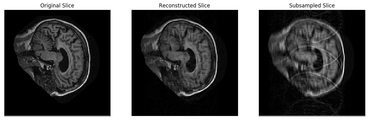 Image of a reconstruction diff plot for a saggital plane brain MR image slice