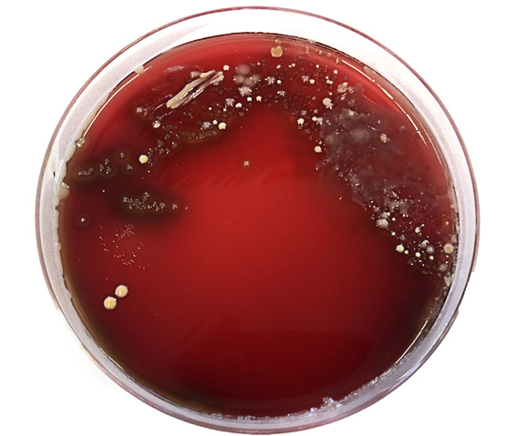 Mixed bacterial growth on a blood agar plate following culture of a contaminated milk sample. Photo: Alan Johnson.