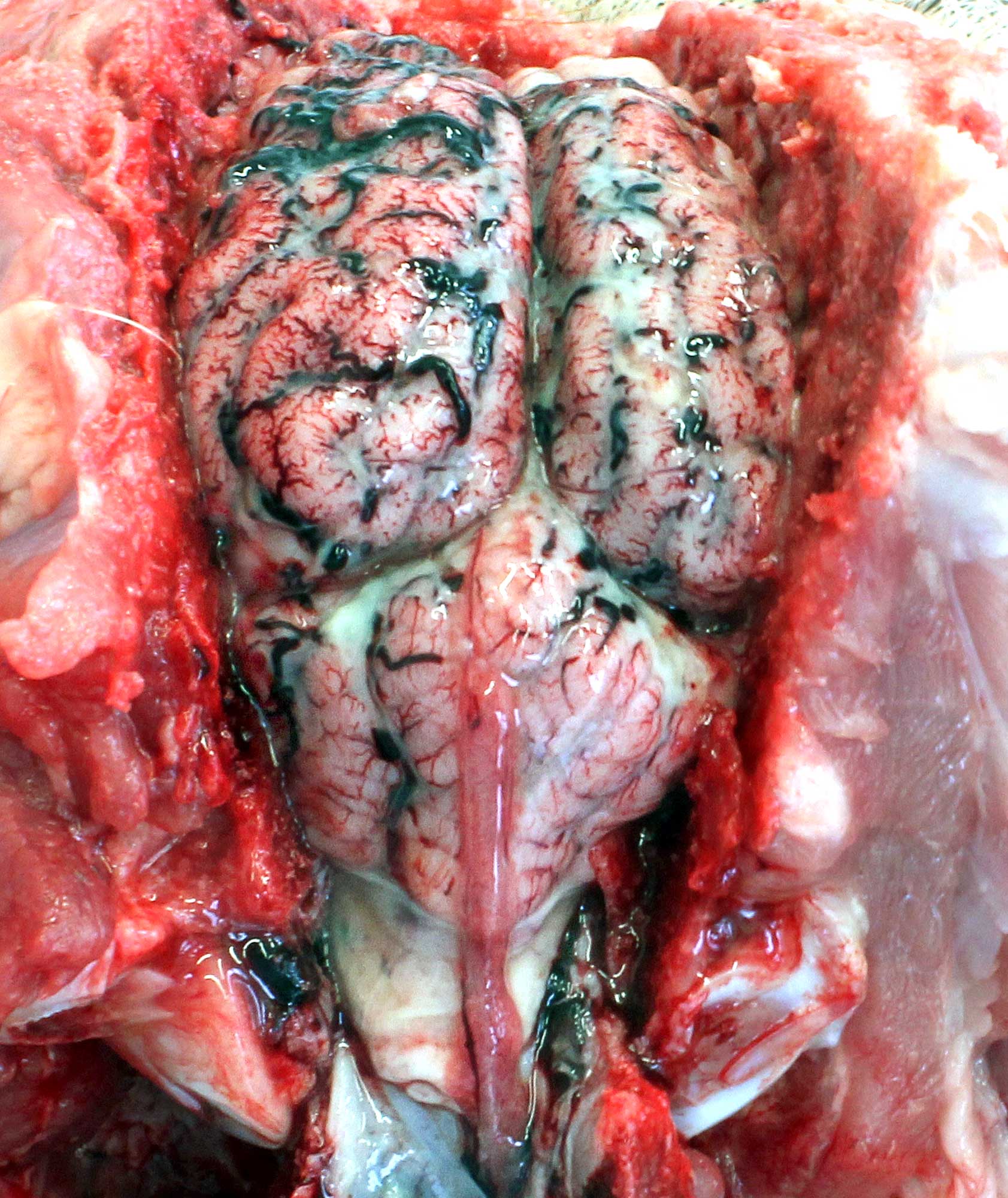 Fibrinosuppurative meningitis. Cranial view. Pale yellow-white exudate in the subarachnoid space, composed of neutrophils, fibrin and bacteria, and caused by Streptococcus suis type 2. Photo: Shane McGettrick.