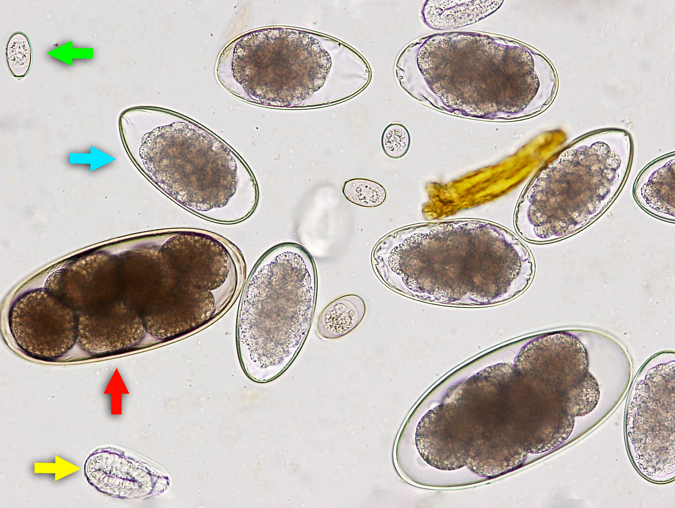 Modified McMaster fecal egg counting. Microscopic appearance of parasitic eggs and oocysts in a faecal smear: *Trichostrongyles* (blue arrow), *Nematodirus* (red arrow), Larvated *strongyloid* egg (yellow arrow) and *coccidial* oocysts (green arrow). Photo: Cosme Sánchez-Miguel.