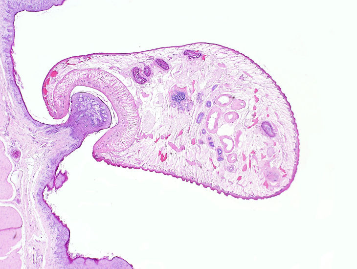 Microphotography of a Rumen fluke (Calicophoron daubneyi) attached to the rumen wall by its oral sucker. Photo:Cosme Sánchez-Miguel.