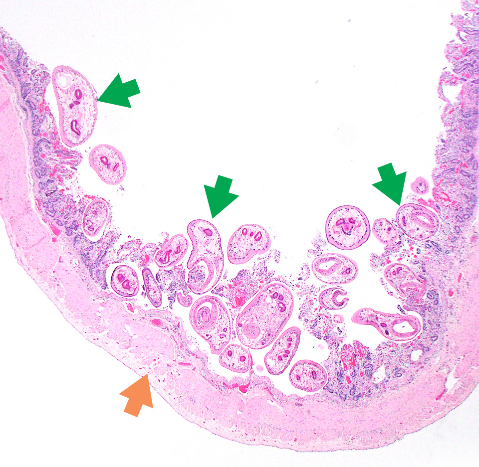 Microphotograph of rumen fluke (Calcicophoron daubneyi) in the small intestine. Photo: Seamus Fagan.