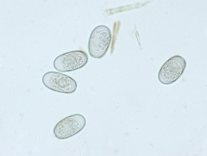 Microphotography of coccidial oocysts in a faecal smear (faecal flotation). Photo: Cosme Sanchez-Miguel.