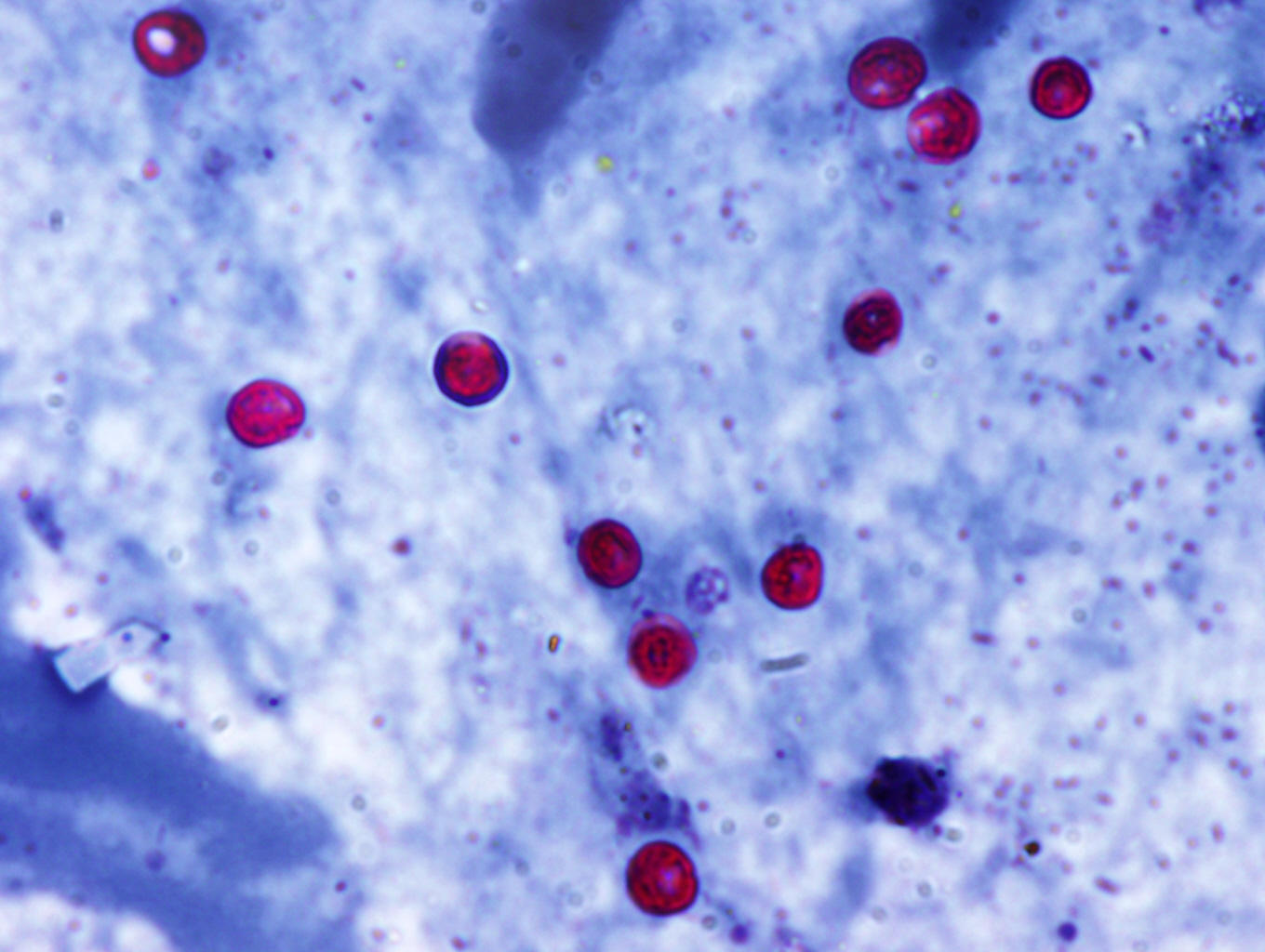 Cryptosporidial oocysts in a faecal smear, modified Ziehl-Neelsen (ZN) stain. Photo: Cosme Sanchez-Miguel.